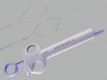 Sonnet® Short-Throw Polypectomy Snare